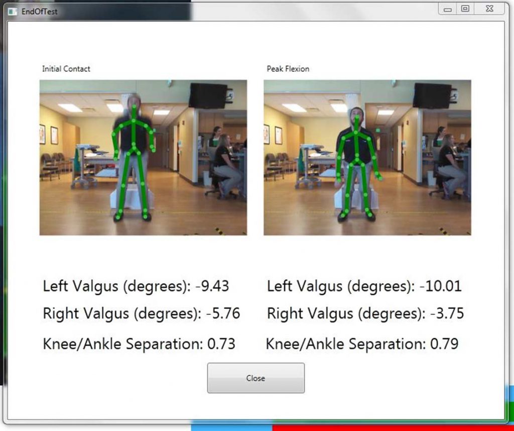 Screenshot of the ACL Gold measurements at initial contact and peak flexion, as captured by the Microsoft Kinect during the Drop Vertical Jump