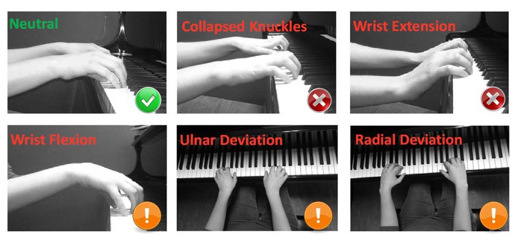 Figure 2. Hand postures observed for pianists. Extended periods of time spent in the non-neutral posture can be harmful for the pianist.